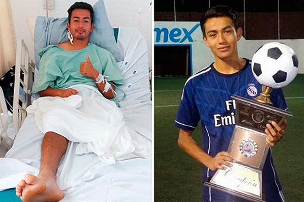 В Мексике 27-летний футболист остался без ноги