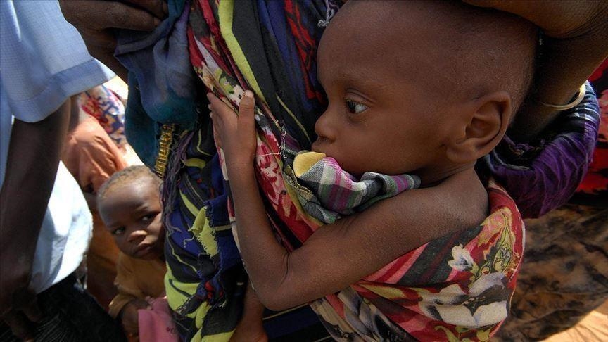 ФАО ставит перед собой цель покончить с голодом в мире к 2030 году, заявил представитель ООН