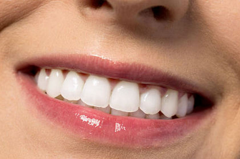 Белые зубы - реальность: как в домашних условиях достичь результата