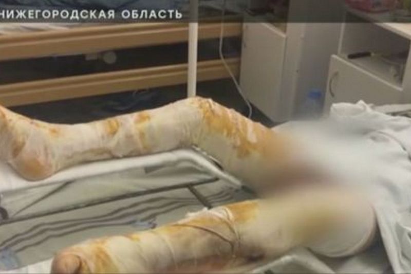 В Нижегородской области подростки подожгли восьмилетнего школьника