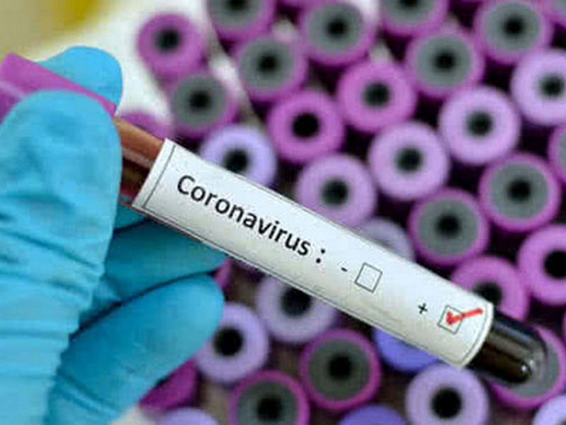 В России главврач госпиталя «выпала» из окна во время совещания о начале приема больных с коронавирусом