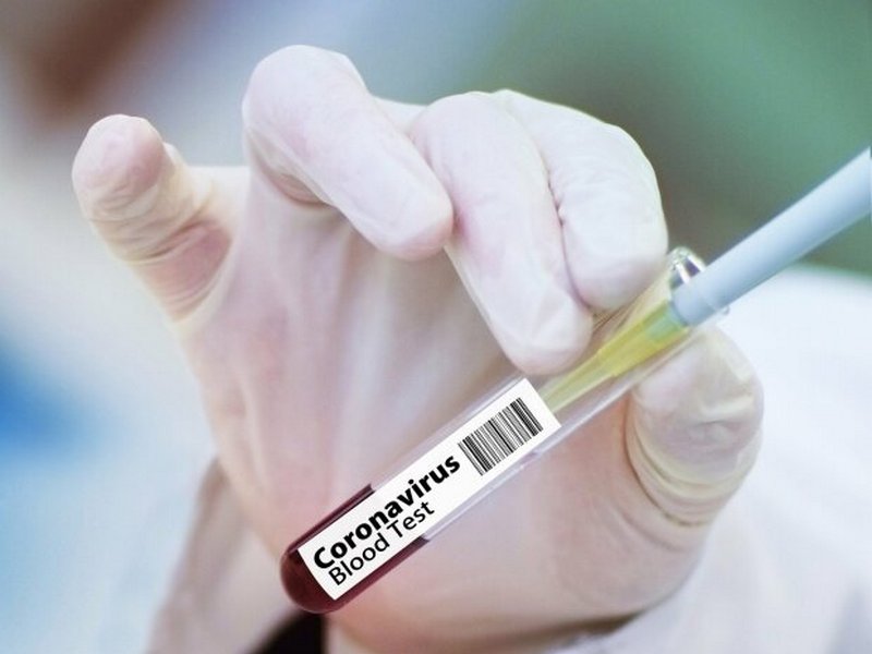 В Украине зафиксировано более 6 тысяч случаев заболевания коронавирусом - Минздрав