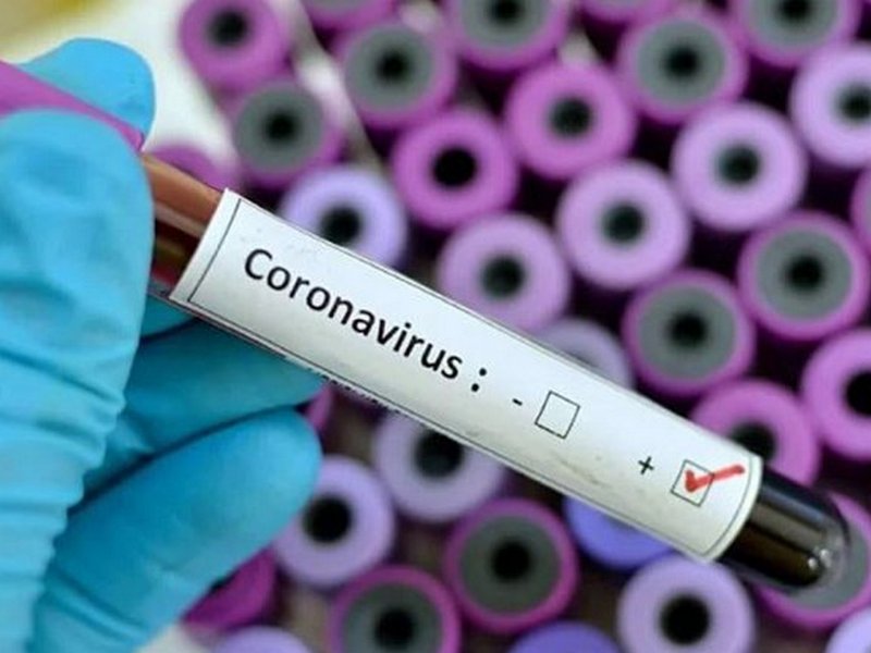 Почти 200 умерших: инфографика и данные по коронавирусу в Украине на 24 апреля